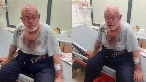 84 yaşındaki Vakıf Başkanı'na saldırı! Beyzbol sopasıyla dövüldü