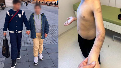 Şiddet gören otizmli çocuk hakkında yeni gelişme!