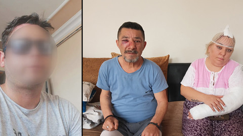 Zammı yapmayan kiracısını öldüresiye dövdü: Ev sahibi tutuklandı!