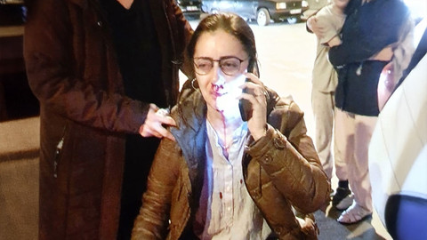 Eşinin sevgilisi sanıp darp etti, gerçek ortaya çıkınca 'pardon' dedi