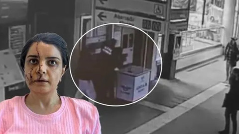 Yüzüne 40 dikiş atılmıştı! Savcı görüşünü açıkladı