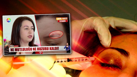 Estetik mağdurundan sahte doktor iddiası: Kaşını kaldırtacaktı, hayatı altüst oldu!
