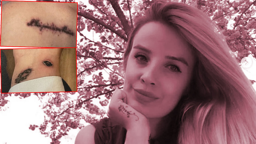 Ünlü yazar dövmelerini sildirirken kabusu yaşadı! İşlemi yapanların hapsi isteniyor