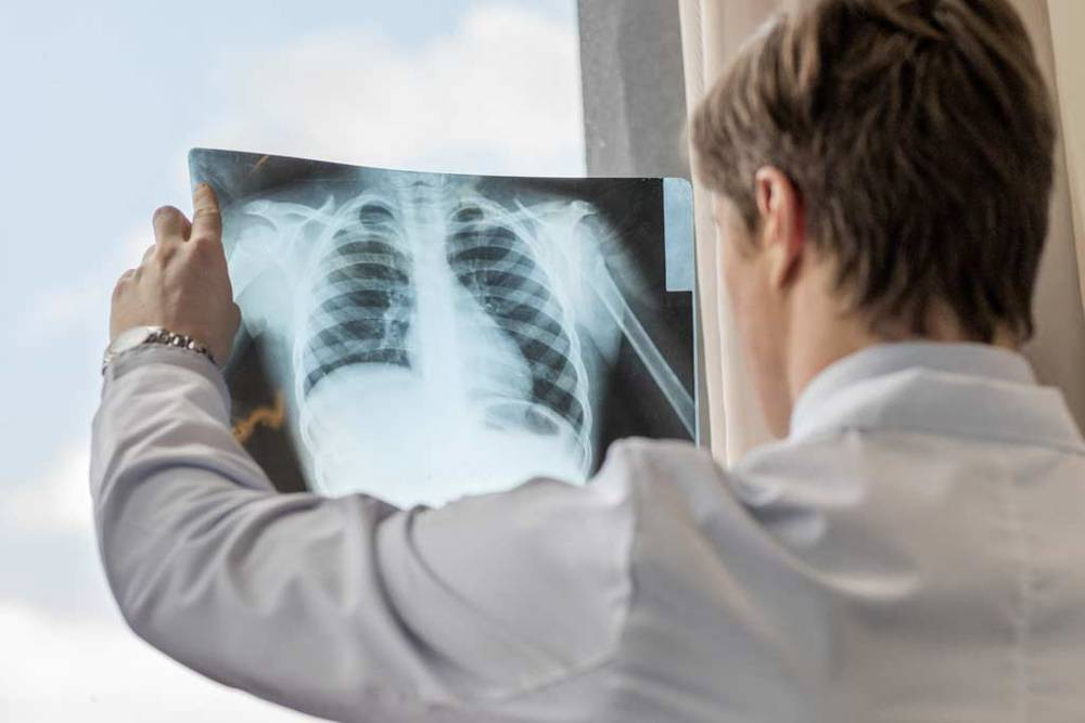 Göğüs Ağrısı Neden Olur Belirtileri Tedavisi 9