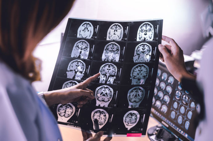 Odtulu Bilim Insanlarindan Yeni Calisma Alzheimeri Erken Evrede Tespit Edilecek 28 S U B A T2024 3