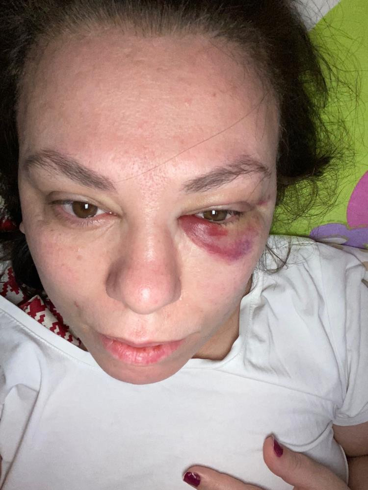 Otobüste Yer Isteyen Kadın Yumruklu Saldırıya Ugradı 20Subat2024 5