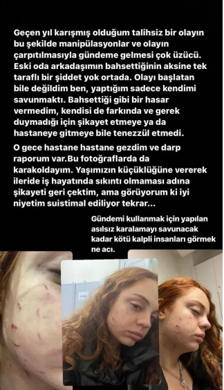 Youtuber Cemre Demirelin Sevgilisinden Dayak Suclamasi Demirelin Savunmasi Pes Dedirtti 15Subat2024 2
