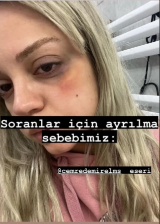 Youtuber Cemre Demirelin Sevgilisinden Dayak Suclamasi Demirelin Savunmasi Pes Dedirtti 15Subat2024 3