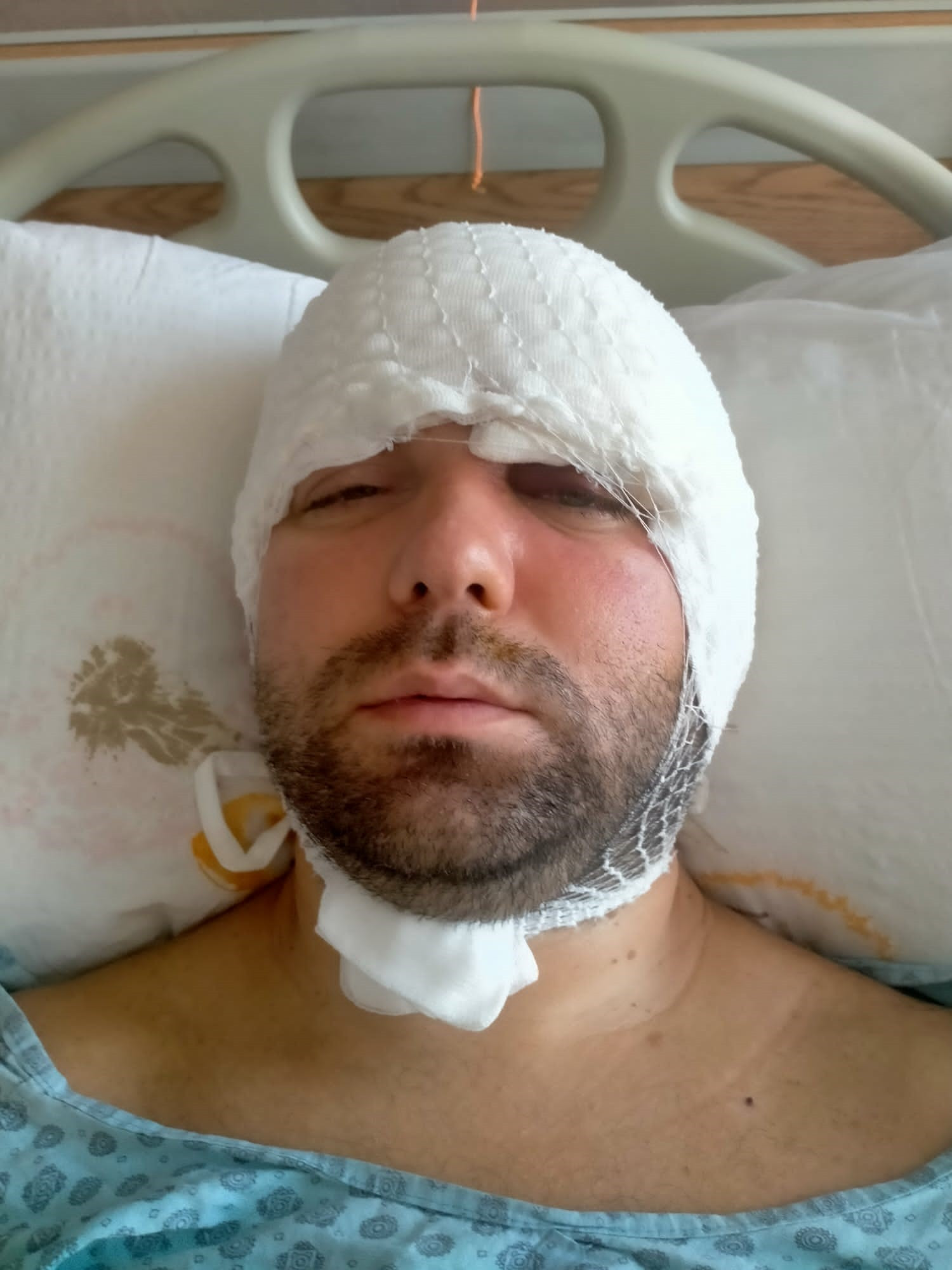 Bursa Implant 21042024 Iha (4)