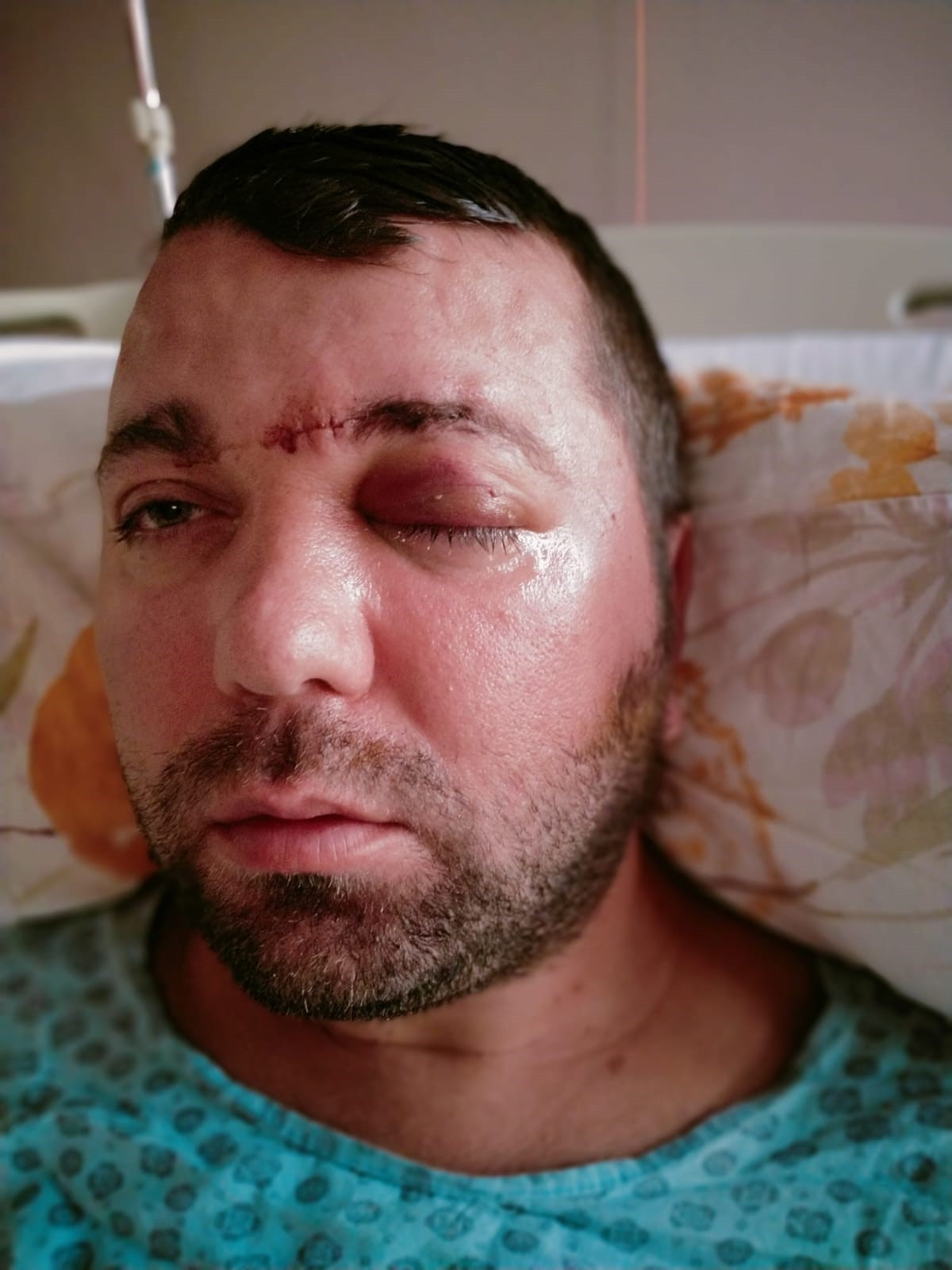 Bursa Implant 21042024 Iha (5)