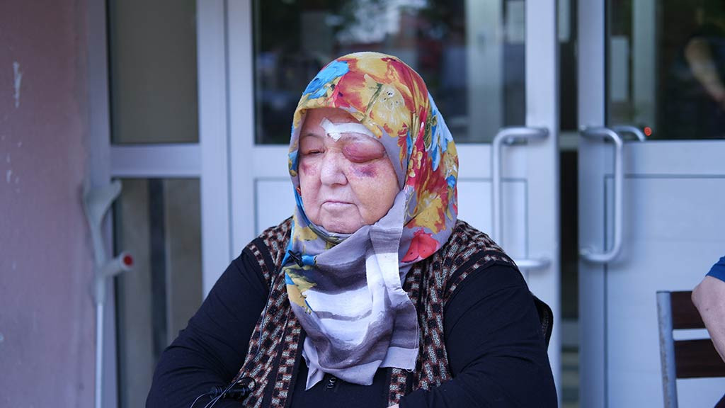 Edirne Kopekler Yasli Kadina Saldirdi 16042024 Iha4
