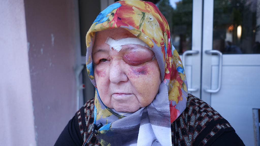 Edirne Kopekler Yasli Kadina Saldirdi 16042024 Iha5