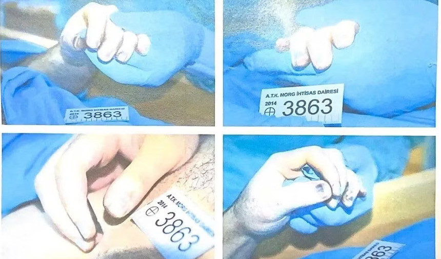 Cem Garipoglu Otopsi 2Jpg