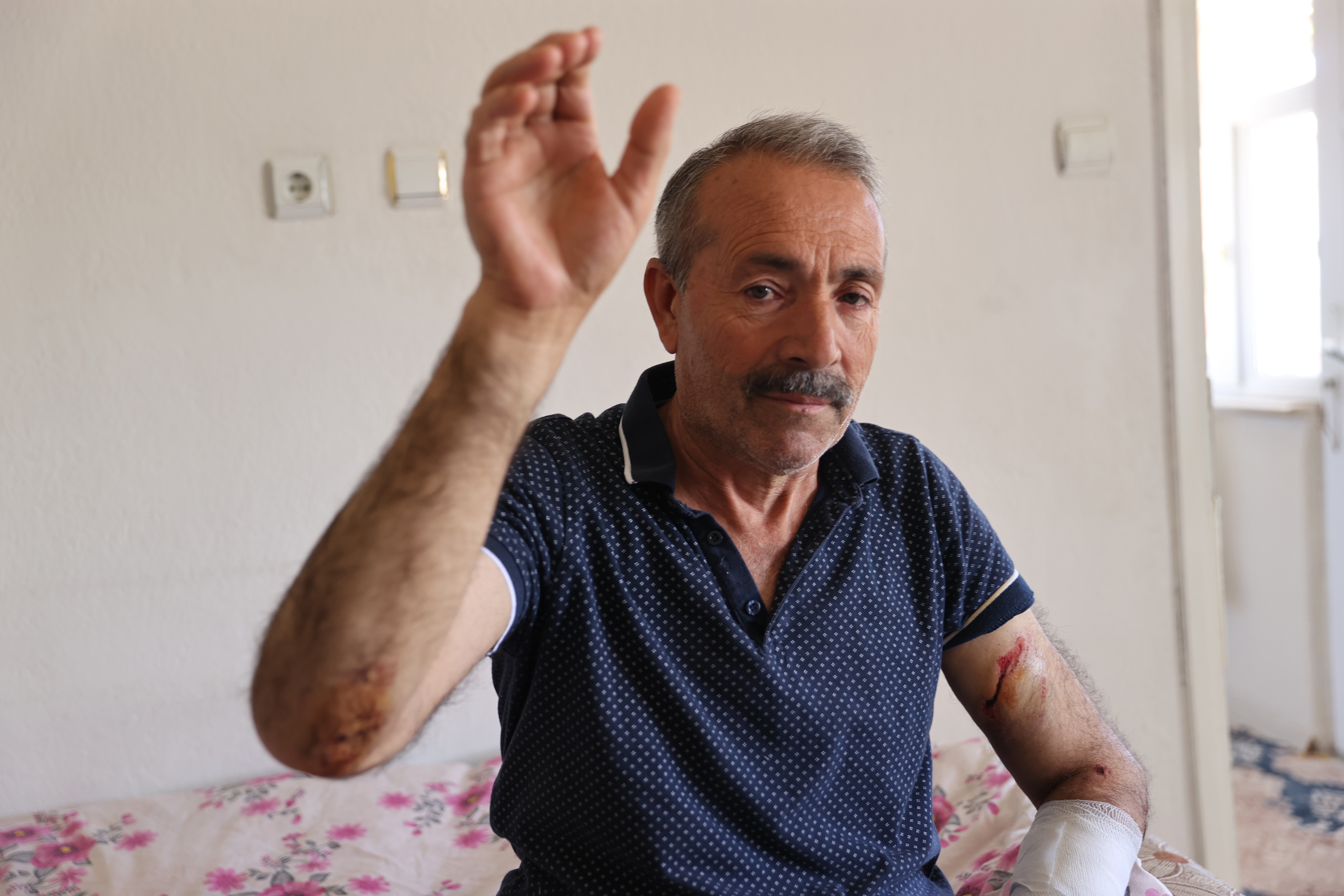 Nevsehir Sokak Kopekleri Teroru 29052024 Aa2